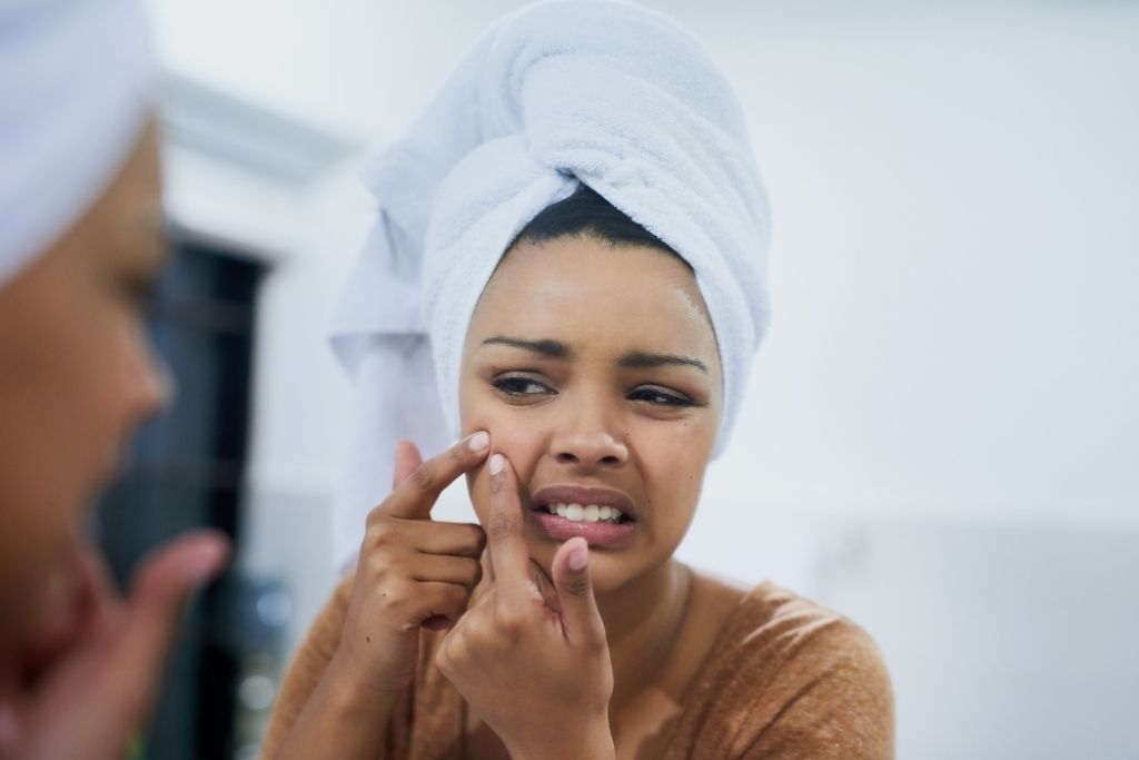 How To Cover Up Acne