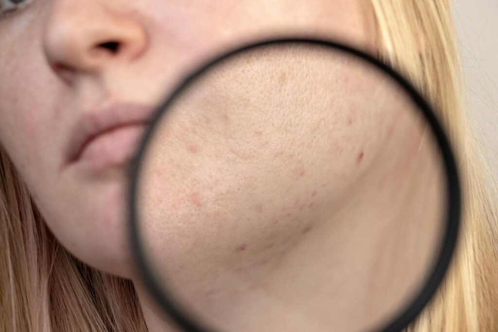 What Is “glass Skin”